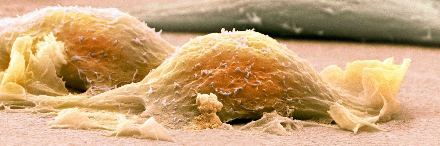 cancer-biology-mcd-biox405